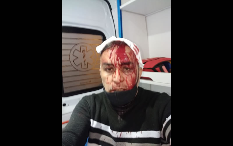 Fue a reclamar, le rompieron la cabeza y recibió tres puñaladas en la espalda
