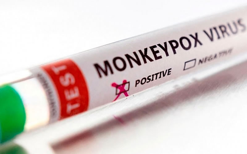 Viruela símica en Argentina: Subieron a 133 los casos en todo el país