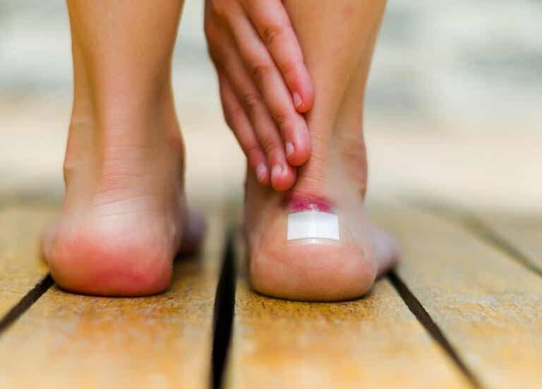 Irritación en la piel por fricción: Prevención, cuidados y tratamientos