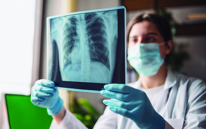 La bronquiolitis sigue en aumento en Argentina: Ya superó en más de un 60% a los niveles prepandémicos