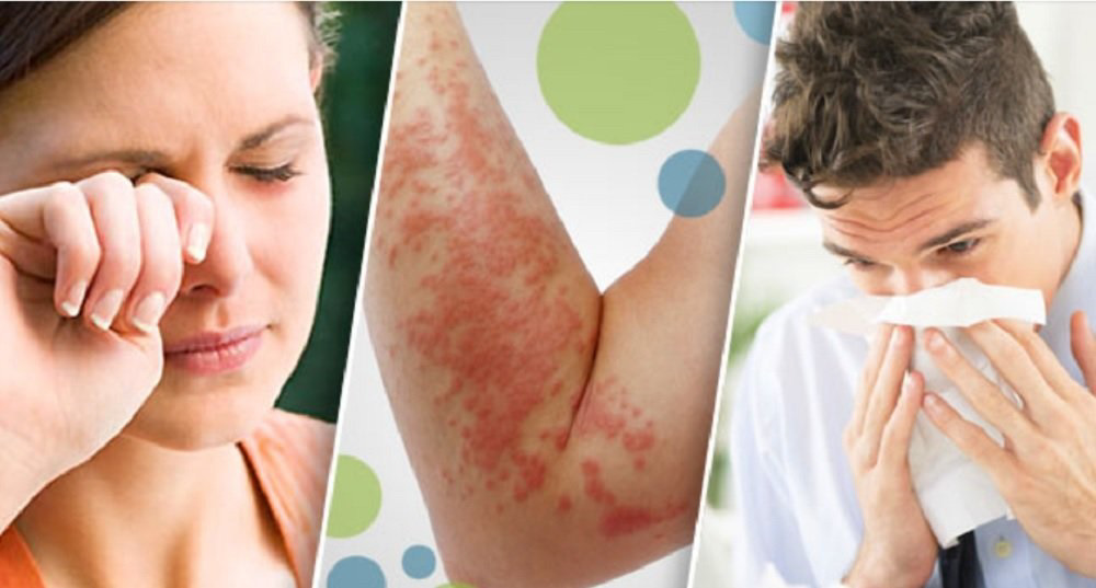 Día Mundial de la Alergia