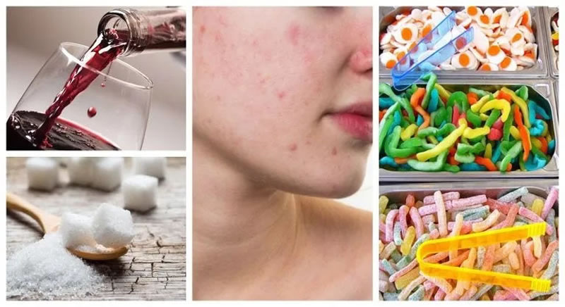 ¿Cómo influyen en el rostro los malos hábitos alimenticios?