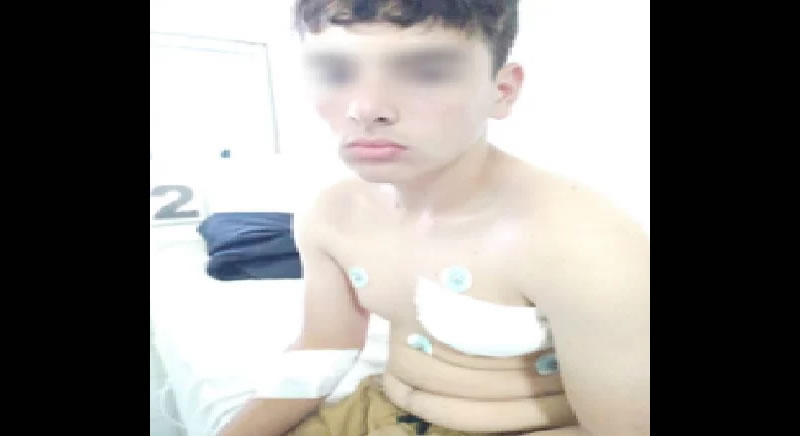 Inseguridad en Concordia: Joven de 17 años recibe una puñalada para sustraerle su mochila de la escuela