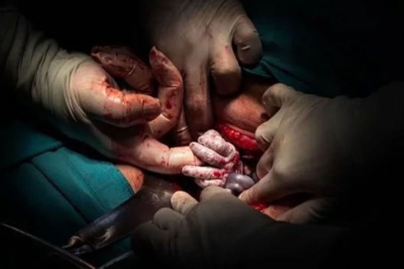 Una entrerriana recibió un premio internacional de oro por una fotografía tomada en un parto