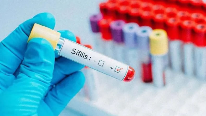 Sífilis: Advierten un crecimiento de más de 40% de esta enfermedad de transmisión sexual
