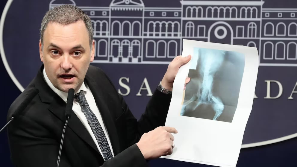 El Gobierno auditará todas las pensiones otorgadas por invalidez laboral