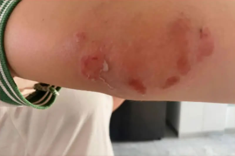 Adolescente fue atacada por una compañera al salir de la escuela: Resultó con costilla fisurada