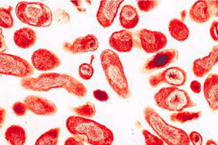 Fiebre Q en Entre Ríos: qué es, cuáles son los principales síntomas y las recomendaciones