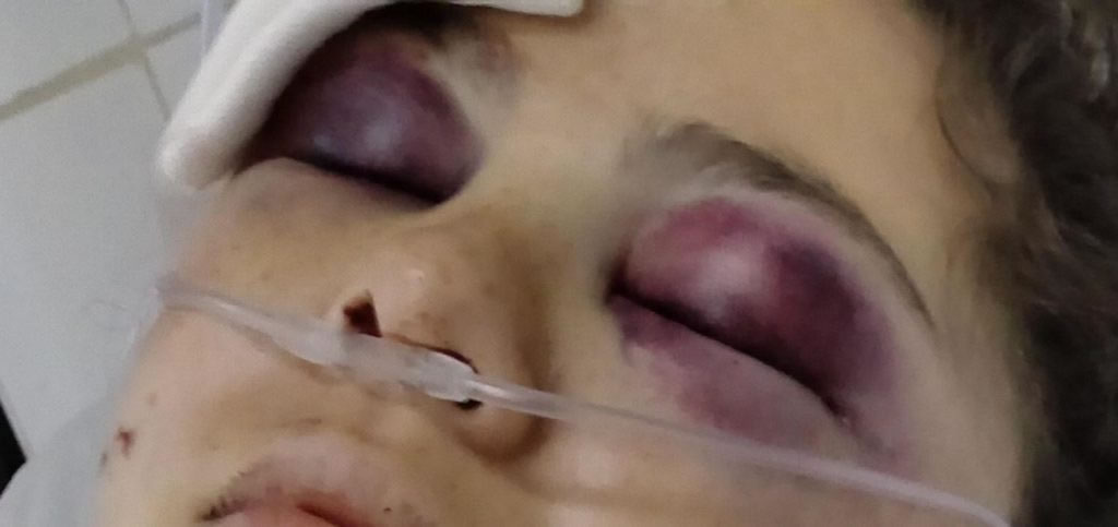 Una joven universitaria fue hallada gravemente herida en Avenida Monseñor Rosch y buscan testigos