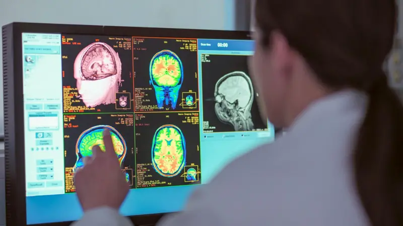 La adolescencia dura hasta los 32 años, según un nuevo estudio (y cuáles son las otras edades clave para el cerebro)